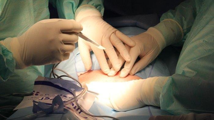 Solusi Baru untuk Luka Parah: RSUD Genteng Tambahkan Layanan Skin Graft